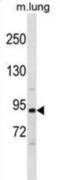 Phosphoinositide-3-Kinase Regulatory Subunit 1 antibody, abx031214, Abbexa, Western Blot image 