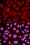 Peptidyl Arginine Deiminase 4 antibody, 18-375, ProSci, Immunofluorescence image 