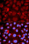 PADI4 antibody, 18-375, ProSci, Immunofluorescence image 