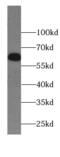 Interferon Induced Protein With Tetratricopeptide Repeats 1B antibody, FNab04136, FineTest, Western Blot image 