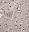 Tet Methylcytosine Dioxygenase 1 antibody, PA5-72805, Invitrogen Antibodies, Immunocytochemistry image 