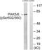 P21 (RAC1) Activated Kinase 5 antibody, PA5-39804, Invitrogen Antibodies, Western Blot image 