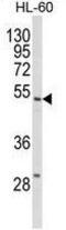 Selenium-binding protein 1 antibody, GTX80973, GeneTex, Western Blot image 