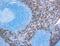 Keratin 5 antibody, NB110-59922, Novus Biologicals, Immunohistochemistry paraffin image 