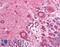 Golgi Associated PDZ And Coiled-Coil Motif Containing antibody, LS-B1356, Lifespan Biosciences, Immunohistochemistry paraffin image 
