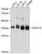 Exosome complex exonuclease RRP43 antibody, A09191, Boster Biological Technology, Western Blot image 