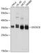 Exosome Component 8 antibody, A09191, Boster Biological Technology, Western Blot image 