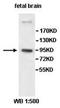 Protocadherin Gamma Subfamily B, 4 antibody, orb77881, Biorbyt, Western Blot image 