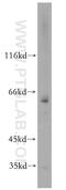 Twinkle protein, mitochondrial antibody, 13435-1-AP, Proteintech Group, Western Blot image 
