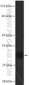 Chromobox 7 antibody, 26278-1-AP, Proteintech Group, Enzyme Linked Immunosorbent Assay image 