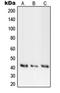 Protein Kinase CAMP-Activated Catalytic Subunit Alpha antibody, orb214435, Biorbyt, Western Blot image 
