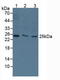 Thymidine Kinase 1 antibody, LS-C373025, Lifespan Biosciences, Western Blot image 