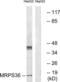 Mitochondrial Ribosomal Protein S36 antibody, LS-C120089, Lifespan Biosciences, Western Blot image 
