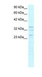 Zinc Finger Protein 385A antibody, NBP1-79983, Novus Biologicals, Western Blot image 