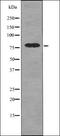 Indian Hedgehog Signaling Molecule antibody, orb339204, Biorbyt, Western Blot image 