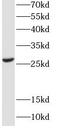 EF-Hand Domain Family Member D2 antibody, FNab02661, FineTest, Western Blot image 