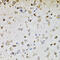 Aldehyde Dehydrogenase 1 Family Member A1 antibody, 18-207, ProSci, Immunohistochemistry frozen image 