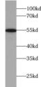 Neutral Cholesterol Ester Hydrolase 1 antibody, FNab00017, FineTest, Western Blot image 