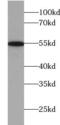 ADCL1 antibody, FNab00017, FineTest, Western Blot image 