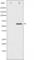 P21 (RAC1) Activated Kinase 1 antibody, abx011315, Abbexa, Western Blot image 