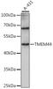 Transmembrane Protein 44 antibody, 16-329, ProSci, Western Blot image 