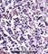 Calpain 11 antibody, abx027657, Abbexa, Western Blot image 
