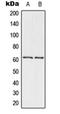 Checkpoint Kinase 2 antibody, orb215552, Biorbyt, Western Blot image 