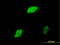 Early Growth Response 1 antibody, LS-C104940, Lifespan Biosciences, Immunofluorescence image 
