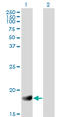 Regulator Of G Protein Signaling 3 antibody, LS-B5527, Lifespan Biosciences, Western Blot image 