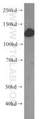 Huntingtin Interacting Protein 1 antibody, 19688-1-AP, Proteintech Group, Western Blot image 