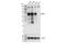 Matrix Metallopeptidase 2 antibody, 40994S, Cell Signaling Technology, Western Blot image 