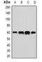 ASPSCR1 Tether For SLC2A4, UBX Domain Containing antibody, LS-B14590, Lifespan Biosciences, Western Blot image 
