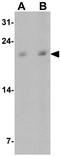 Angiopoietin Like 8 antibody, GTX32128, GeneTex, Western Blot image 