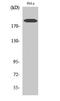 Collagen Type V Alpha 1 Chain antibody, STJ92395, St John