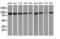 Protein Kinase C Epsilon antibody, LS-C172684, Lifespan Biosciences, Western Blot image 