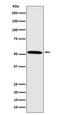 Fukutin antibody, M03344, Boster Biological Technology, Western Blot image 