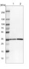 Zinc Finger And BTB Domain Containing 37 antibody, NBP1-81151, Novus Biologicals, Western Blot image 