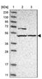 G Protein-Coupled Receptor 150 antibody, NBP1-87287, Novus Biologicals, Western Blot image 