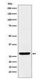 Secretagogin, EF-Hand Calcium Binding Protein antibody, M10629, Boster Biological Technology, Western Blot image 