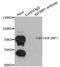 Insulin Like Growth Factor 2 MRNA Binding Protein 1 antibody, LS-C331506, Lifespan Biosciences, Immunoprecipitation image 