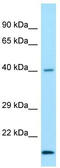 Neuraminidase 3 antibody, TA343356, Origene, Western Blot image 