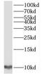 Translocase Of Inner Mitochondrial Membrane 9 antibody, FNab08704, FineTest, Western Blot image 