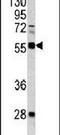 Retroviral integration site protein Fli-1 antibody, PA5-13440, Invitrogen Antibodies, Western Blot image 