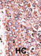 Cellular Communication Network Factor 6 antibody, abx032755, Abbexa, Immunohistochemistry frozen image 