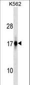 Zinc Finger AN1-Type Containing 2A antibody, LS-C157402, Lifespan Biosciences, Western Blot image 