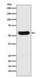 SERPINC1 antibody, M00469, Boster Biological Technology, Western Blot image 