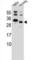 KRAS Proto-Oncogene, GTPase antibody, abx028521, Abbexa, Western Blot image 