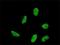 Homeobox A5 antibody, H00003202-M04, Novus Biologicals, Immunocytochemistry image 