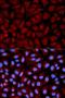Serpin Family C Member 1 antibody, LS-C331551, Lifespan Biosciences, Immunofluorescence image 