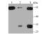 Matrix Metallopeptidase 3 antibody, NBP2-75931, Novus Biologicals, Western Blot image 